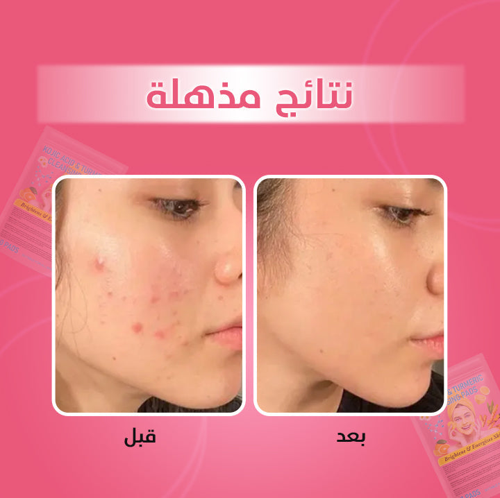 ضمادات الكركم وحمض الكوجيك