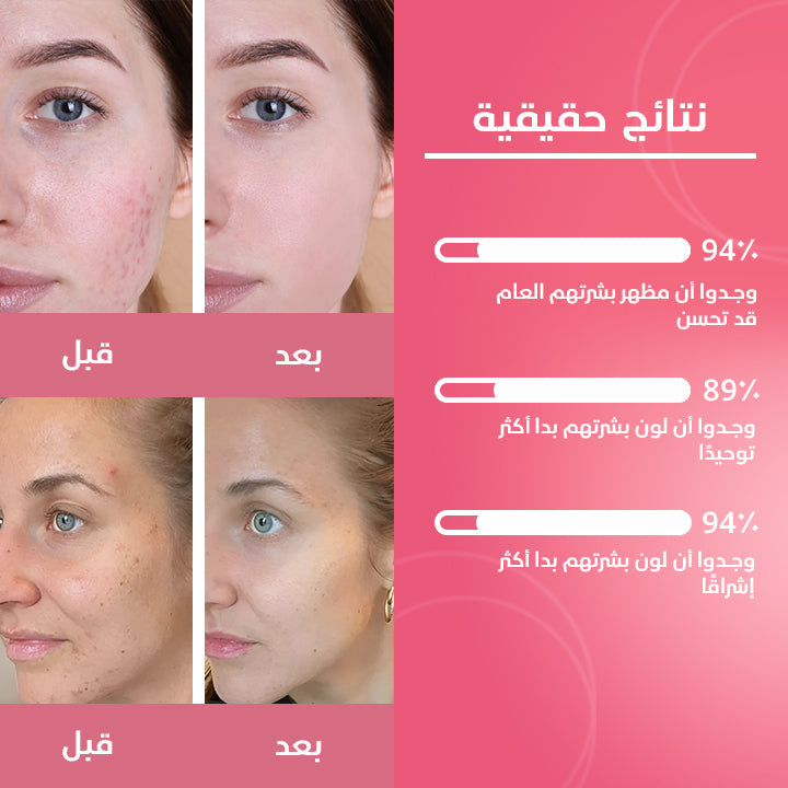 ضمادات الكركم وحمض الكوجيك