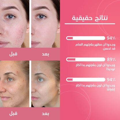 ضمادات الكركم وحمض الكوجيك